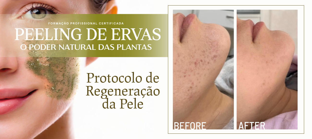Estética Facial